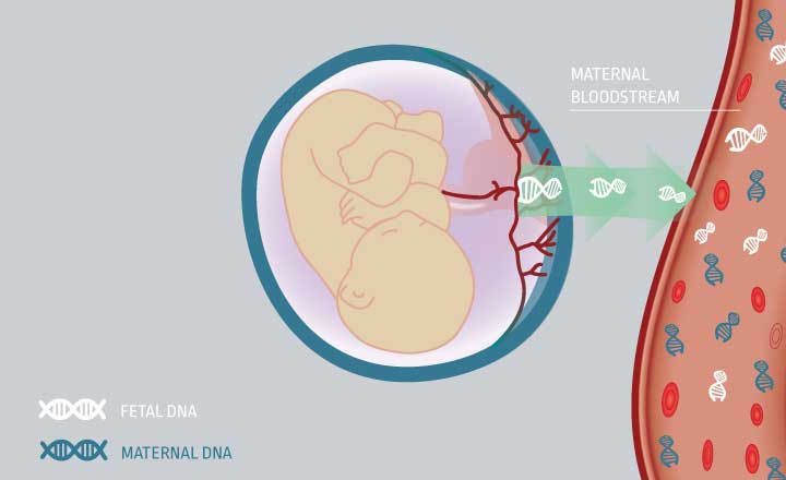 Prequel® Prenatal Test